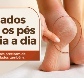 Mão tocando um calcanhar ressecado, ao lado do texto “Cuidados com os pés no dia a dia”.